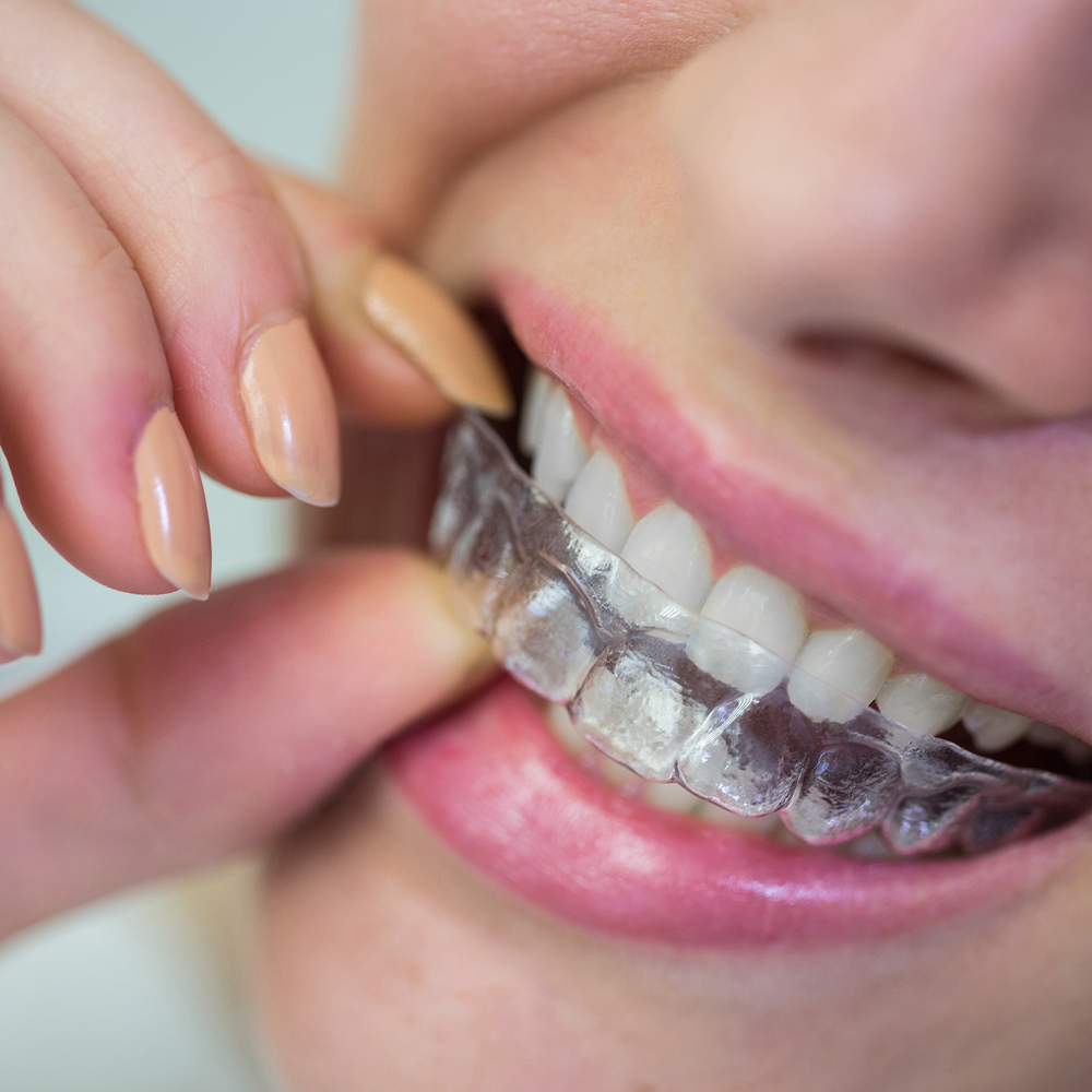 Invisalign® at Plainsboro Family Dentistry in Plainsboro, NJ