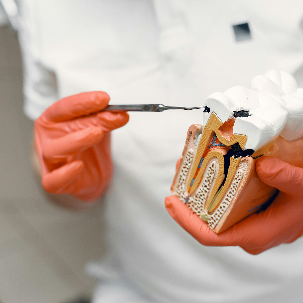 Root Canals at Plainsboro Family Dentistry in Plainsboro, NJ